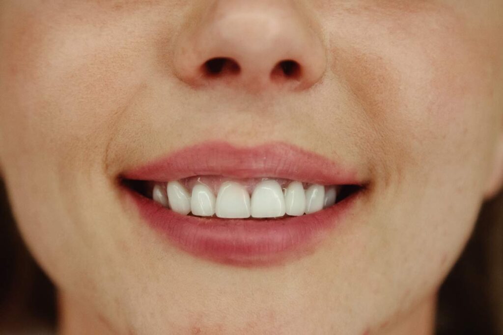 Prevent Tooth Discolouration