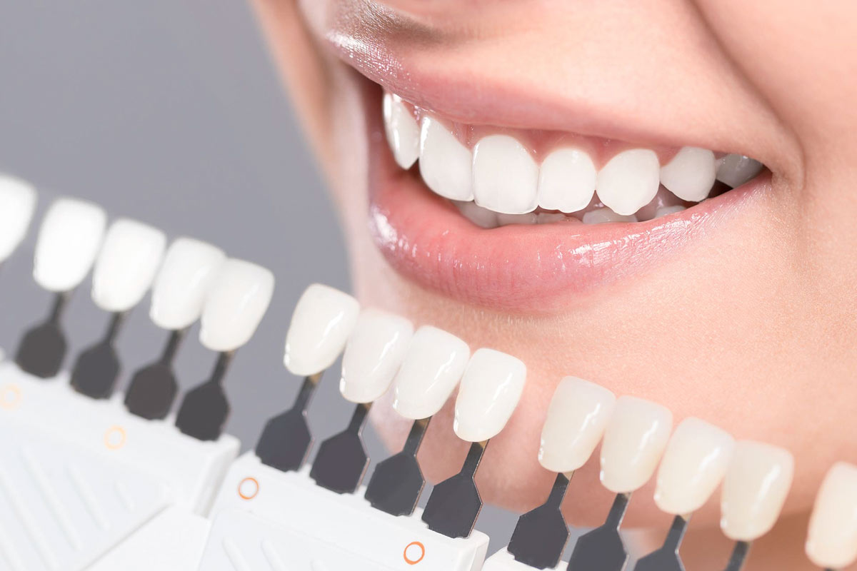 Best Cosmetic Dentistry Services in Thornhill