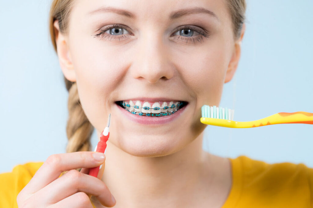 Tips for Maintaining Proper Oral Hygiene While Wearing Braces