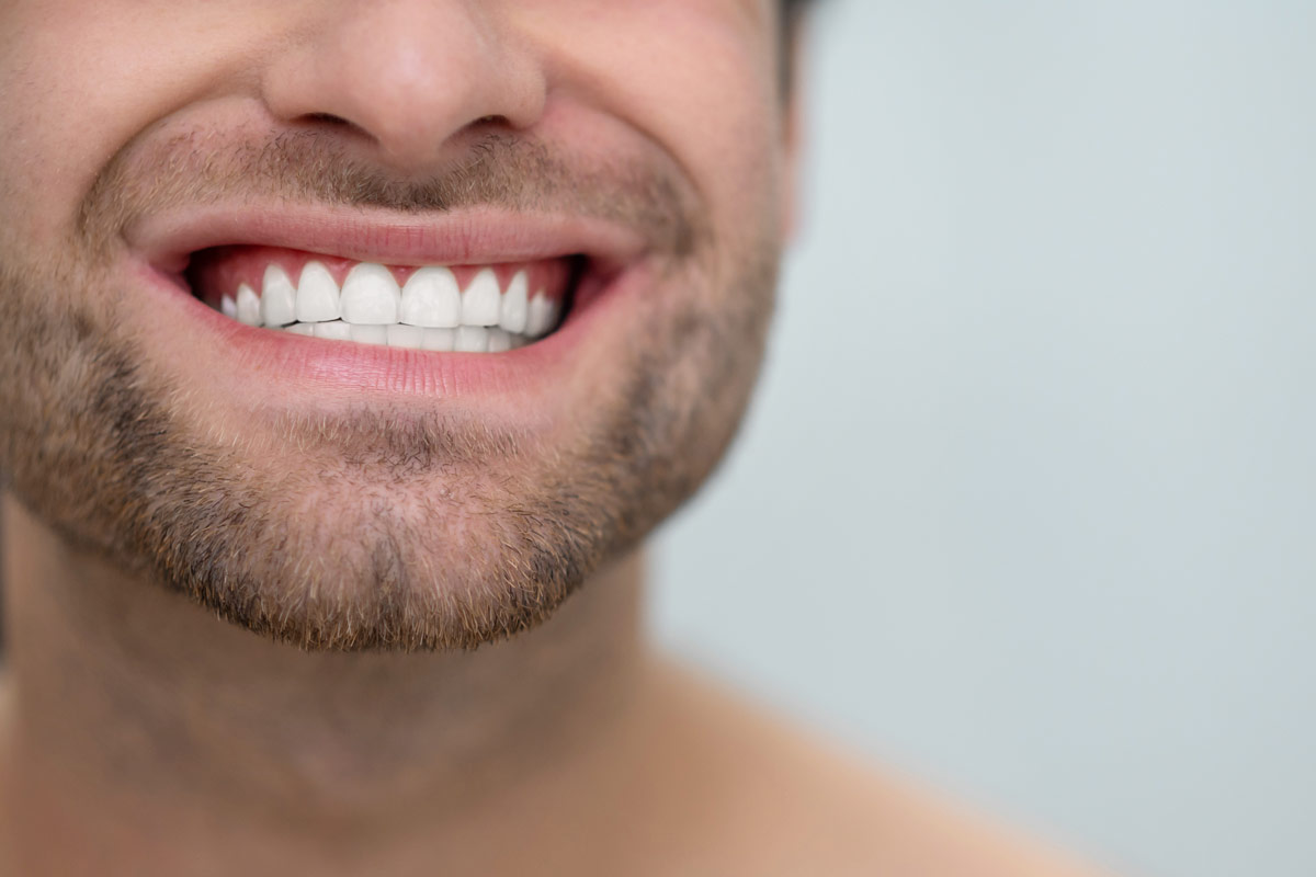 Benefits of Teeth Whitening in Thornhill, Ontario