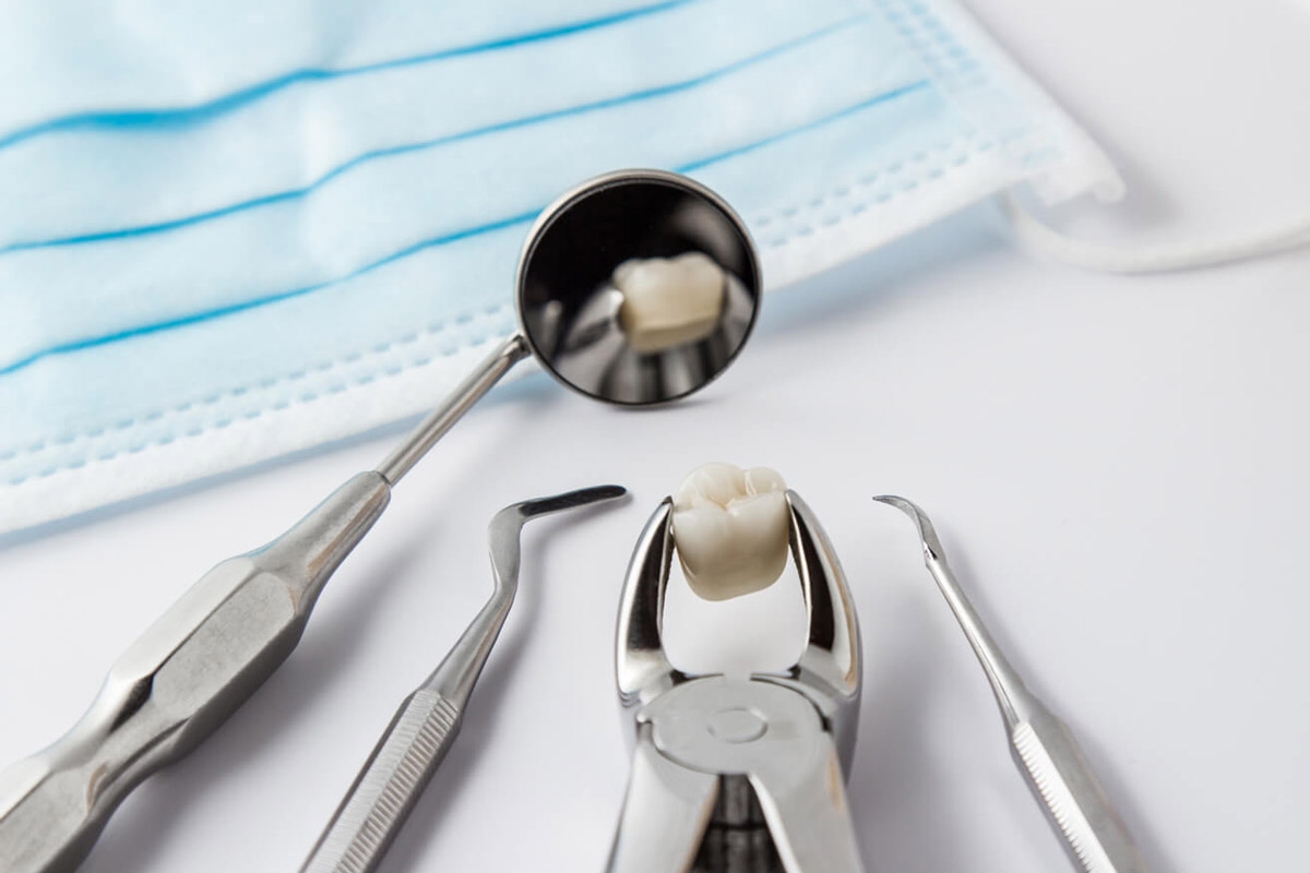 Affordable Tooth Extraction in Thornhill, Ontario