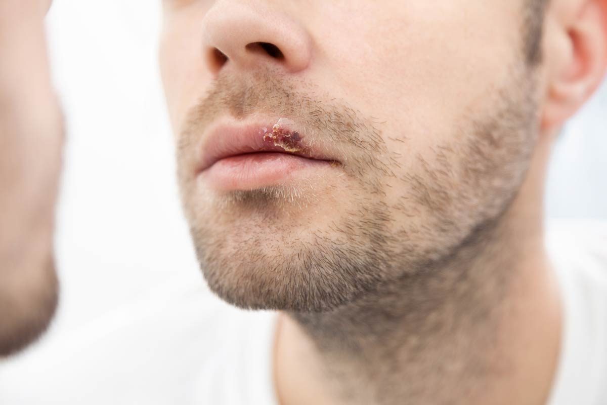 Oral Trouble Oral Trouble