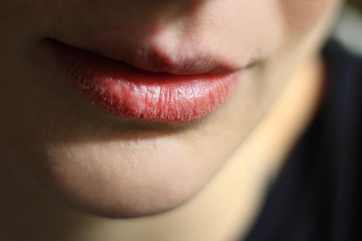 Oral Trouble Oral Trouble