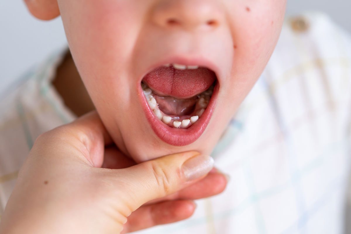 Children's Teeth Toronto