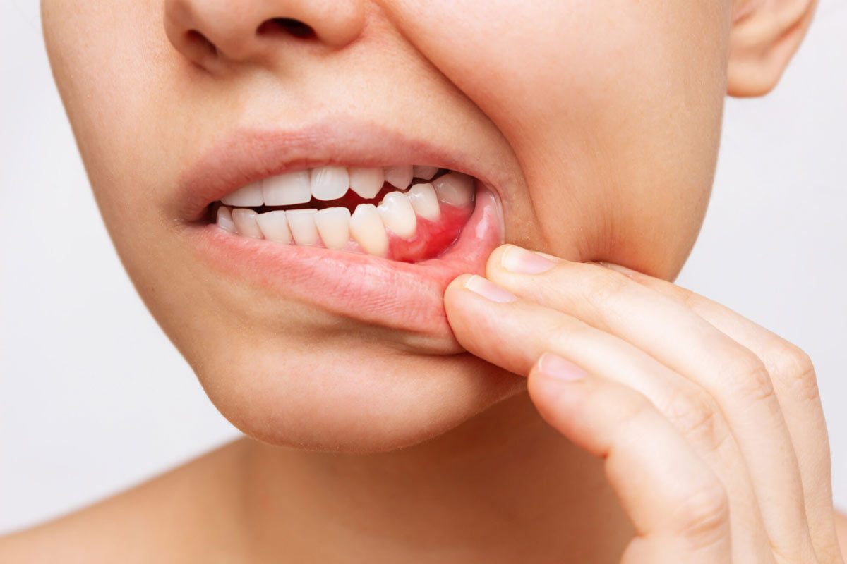 Oral Health Oral Health in Thornhill, Toronto