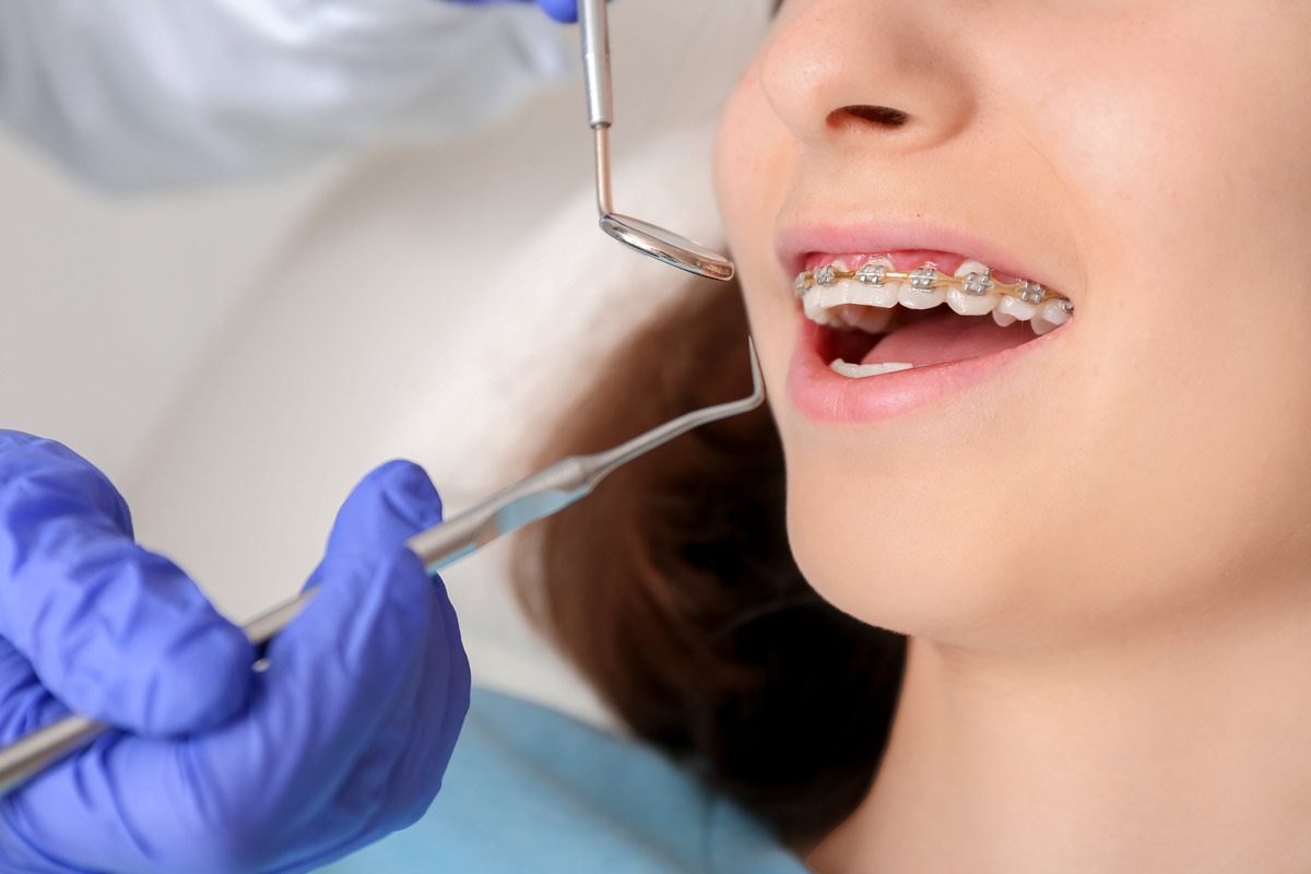 Dental Exam Oral Hygiene Tips for Those Wearing Braces