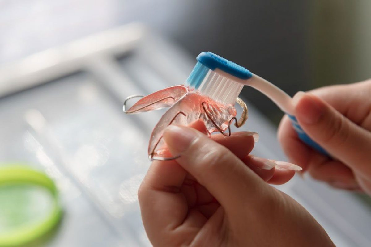 Tips for Cleaning Your Retainers