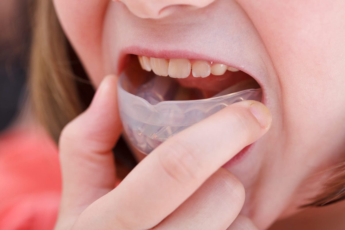 Prevention Strategies for Canker Sores